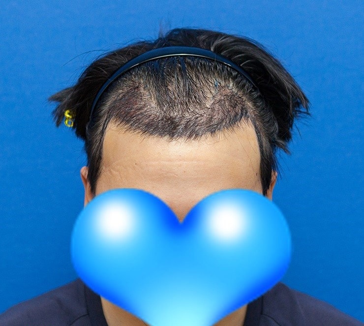 03.jpg