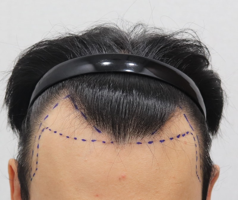 디자인후.jpg