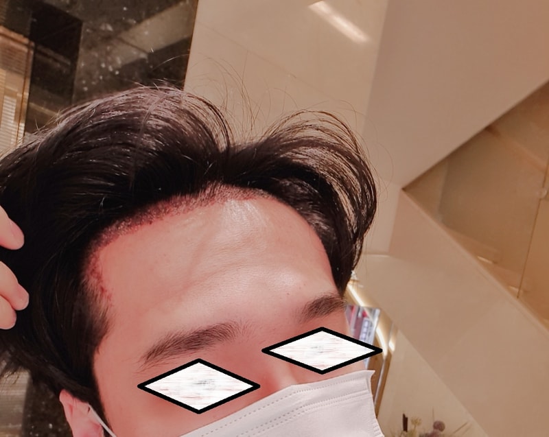 다음날 샴푸후.jpg