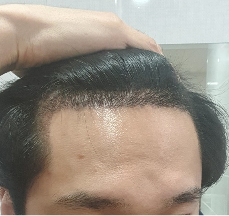 14일후.jpg