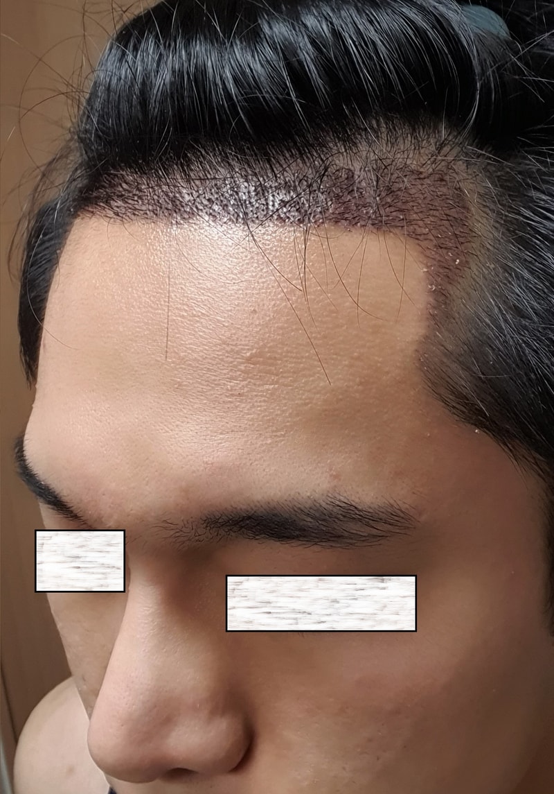 12일후각질제거,지문샴푸.jpg
