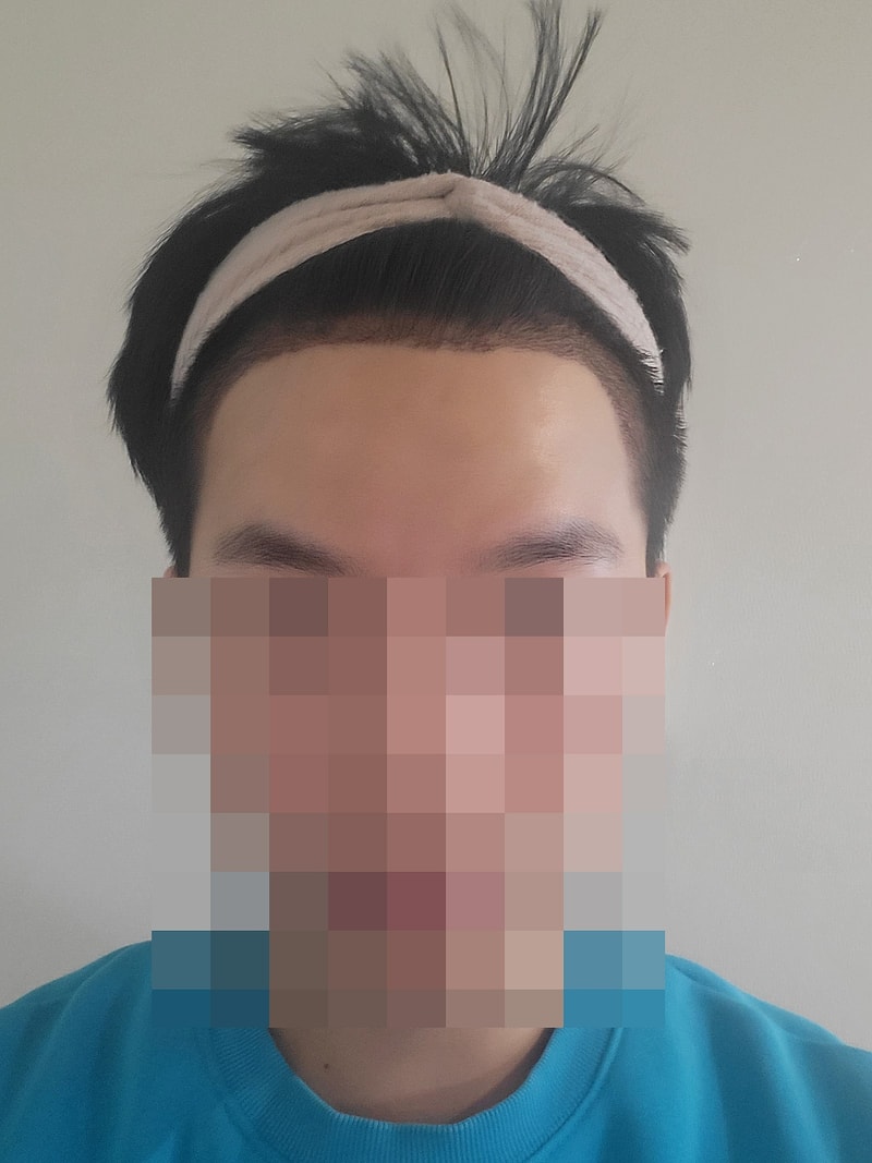 꾸미기정면_후.jpg