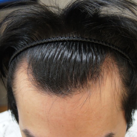 수술전.jpg