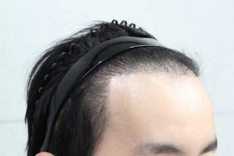 5개월(옆모습).jpg