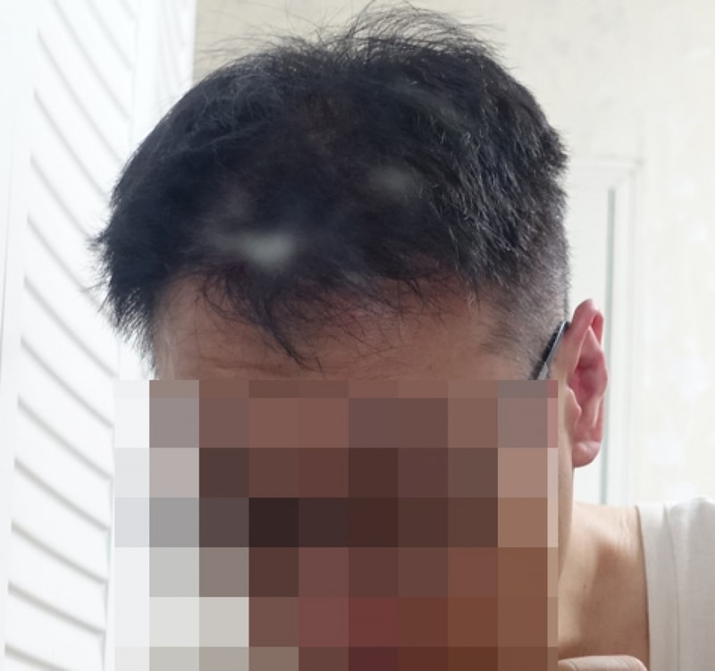 후1년4.jpg