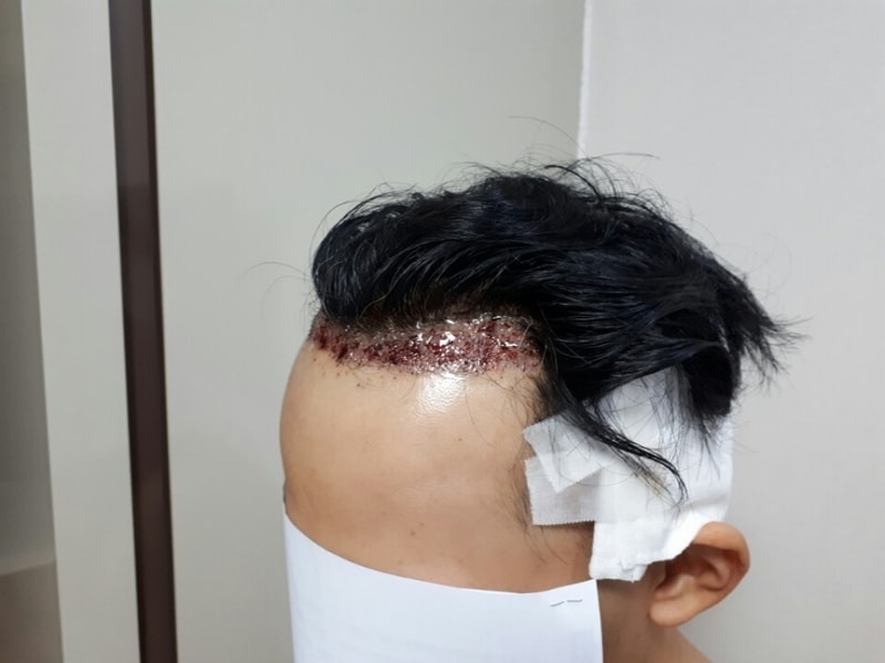 후2.jpg