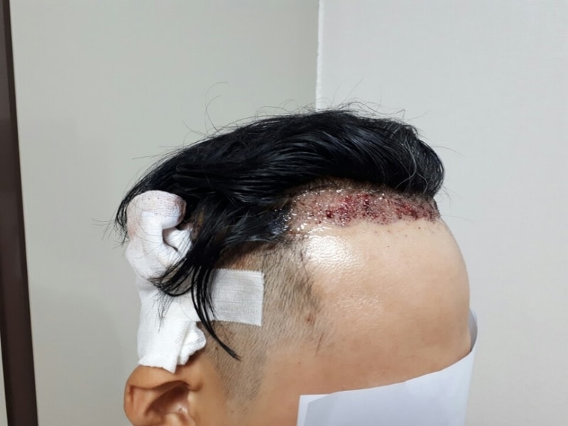 후3.jpg