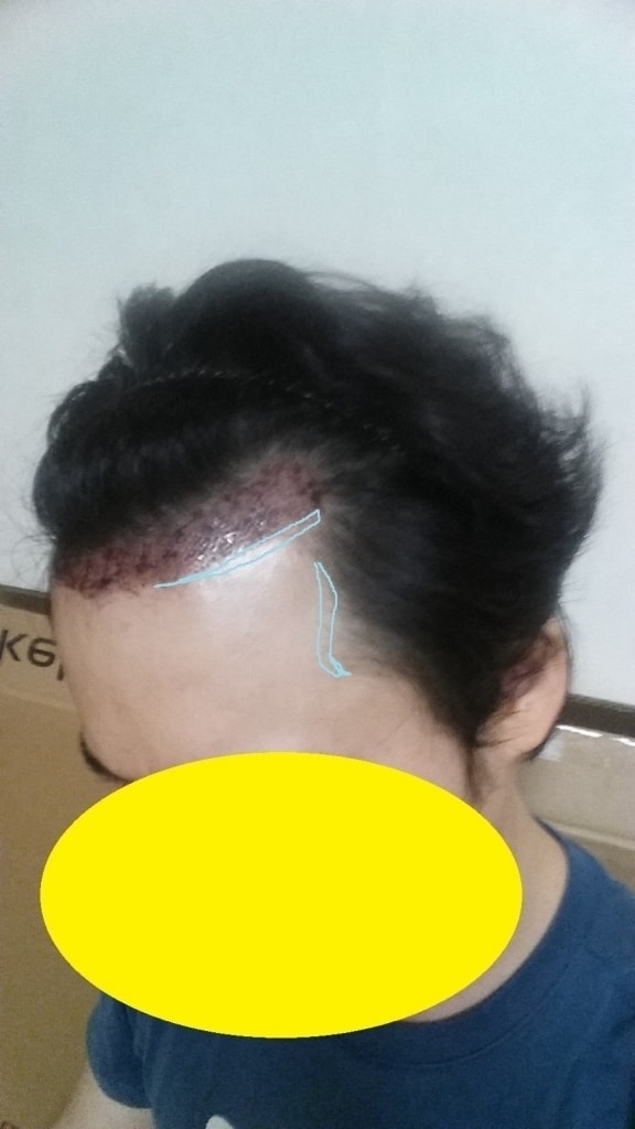 우측.jpg