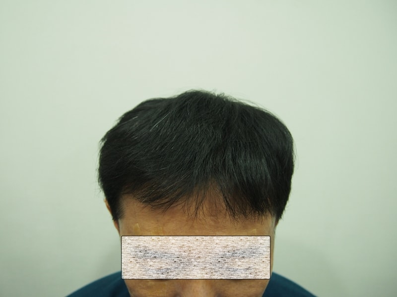 8개월(정면).jpg