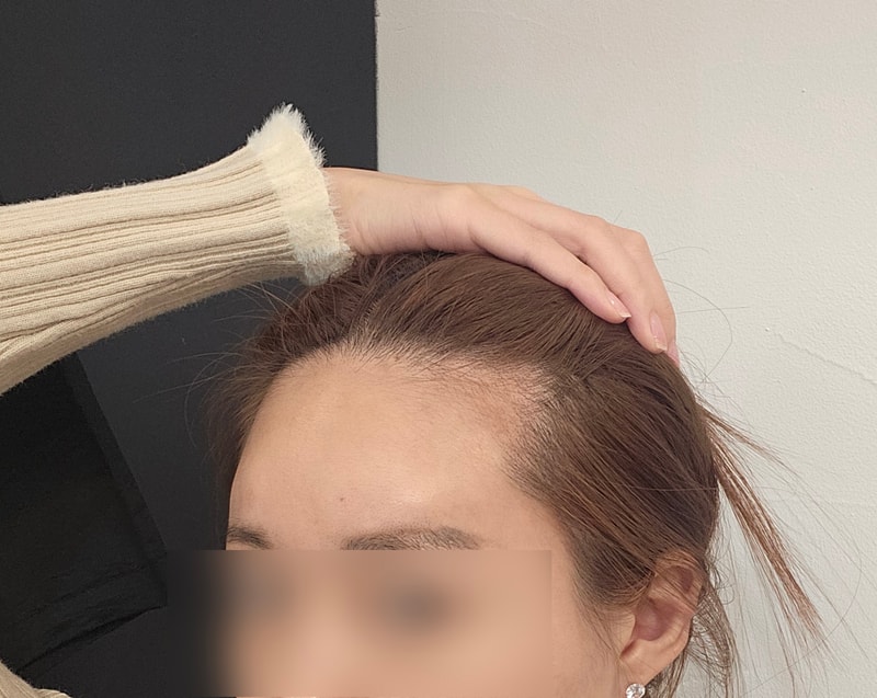 비포 2.jpg