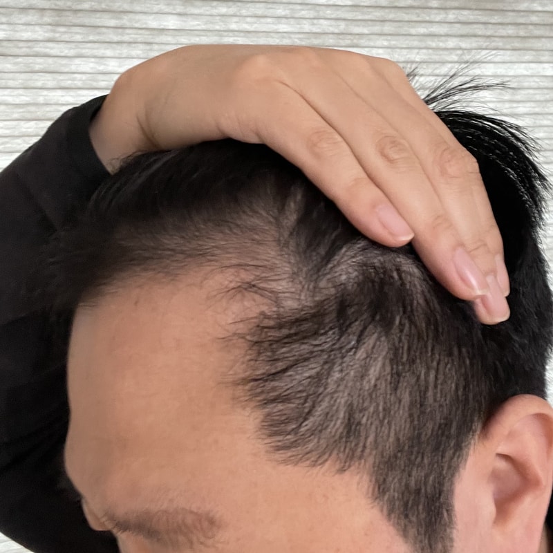 비포 1.jpg