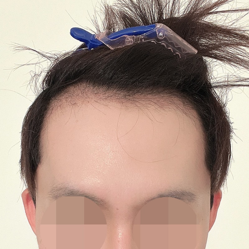 종구_2개월.jpg