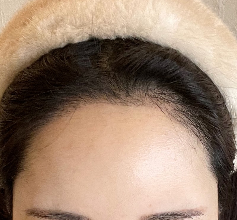 Putting down your forehead is a big success! 2nd month ♥️