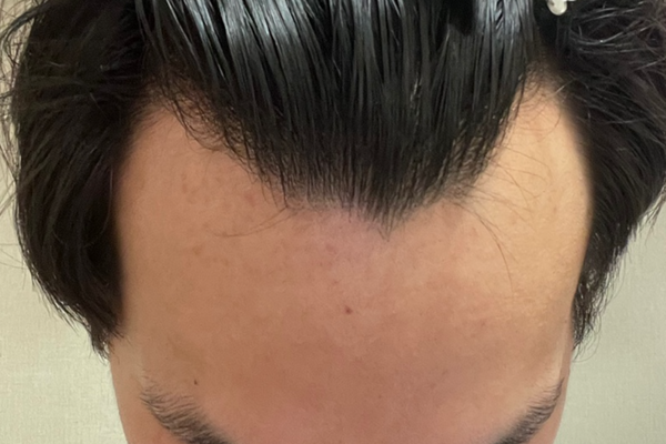 KakaoTalk_20230111_7463451637463 3.png