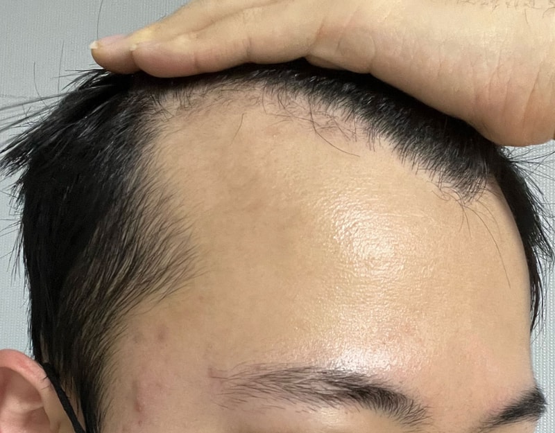 비포 2.jpg