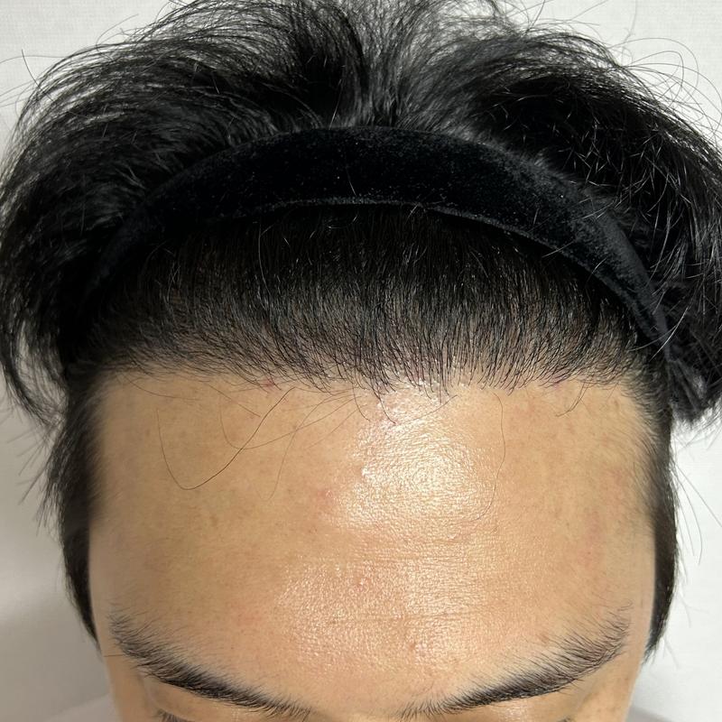 Director Lee Dong-wook of DA's M-ja + 9 months review of 5500 Mo's mixed head hair