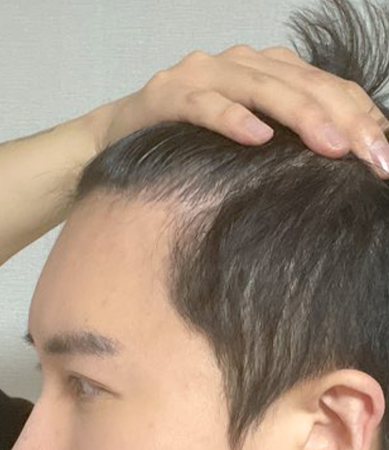후3.jpg