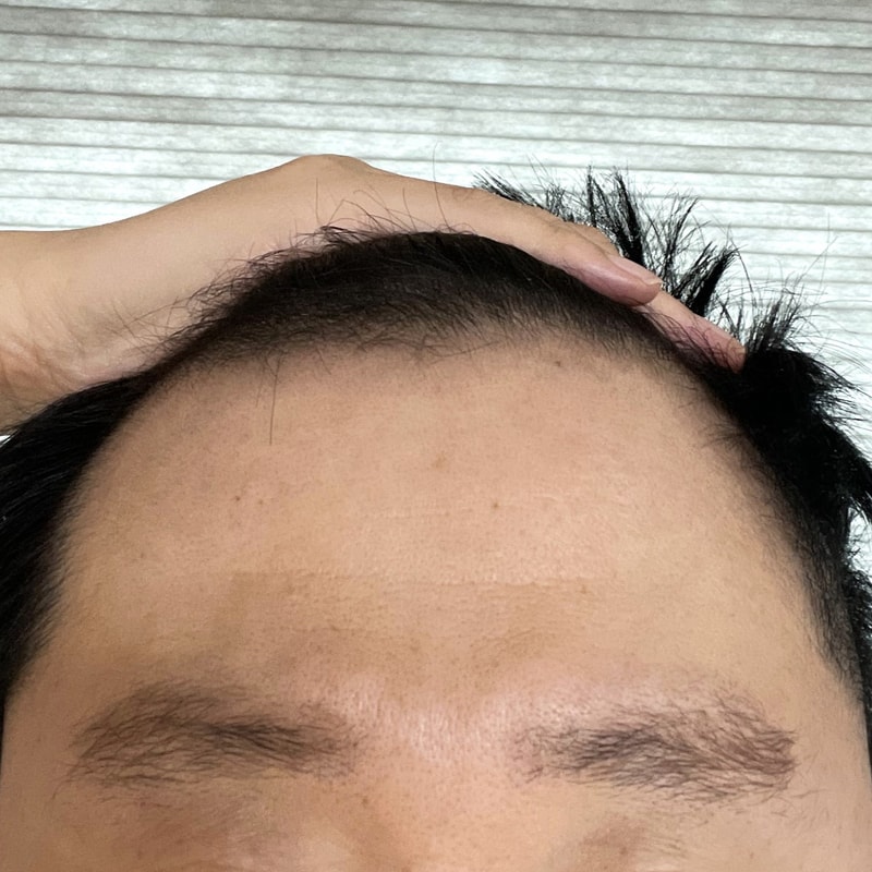 비포 4.jpg