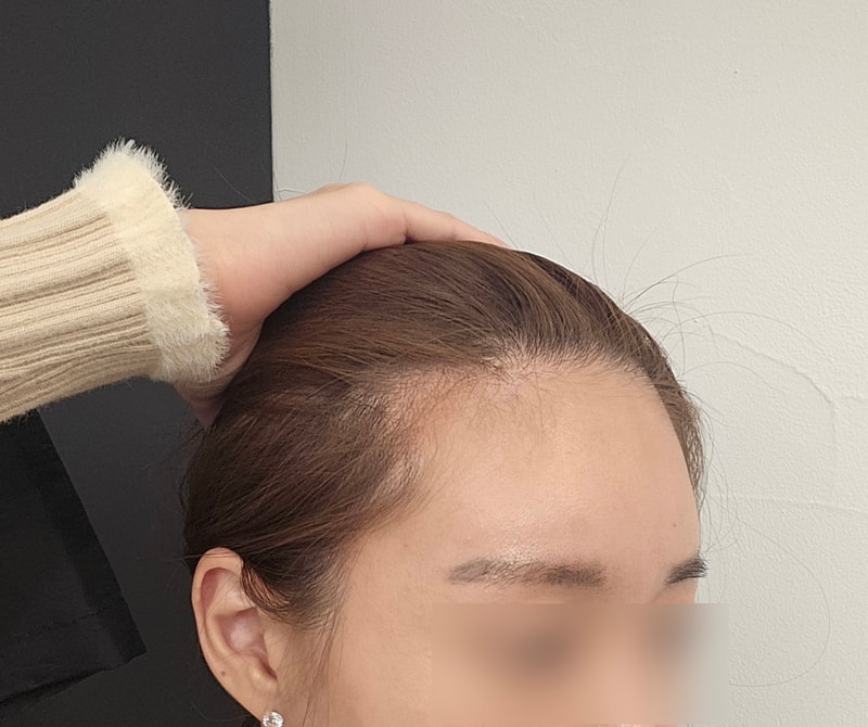 비포 3.jpg