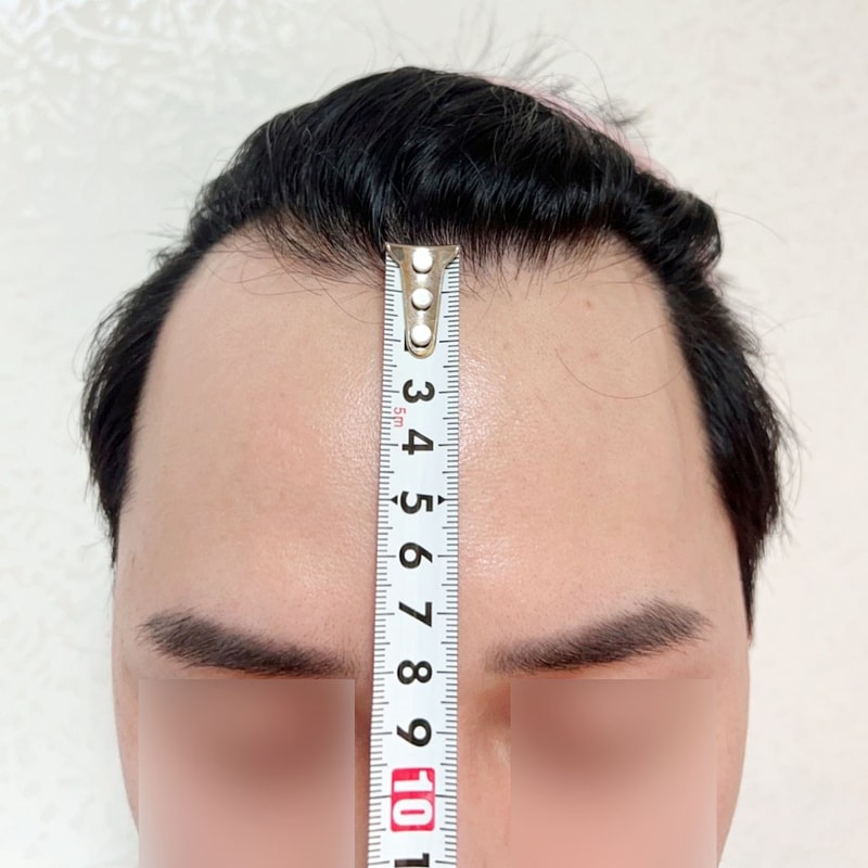 비포 3.jpg