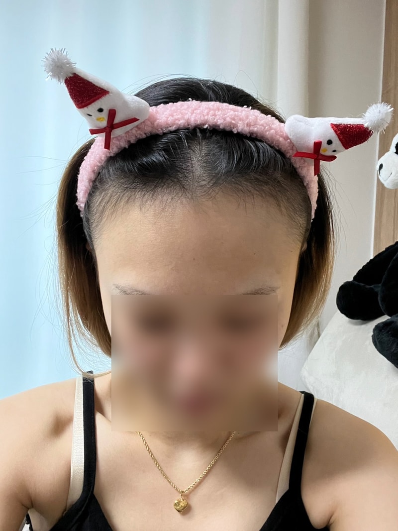 비포 1.jpg