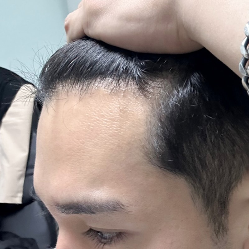 후2.jpg