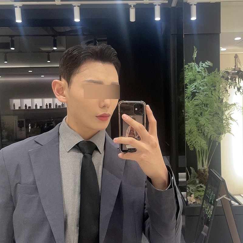 비절개 모발이식 2000모 2달차입니다.
