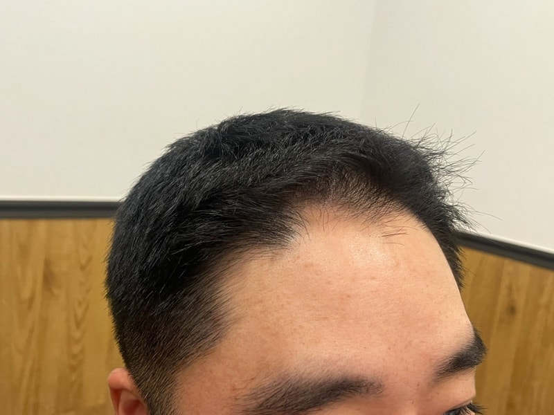 비포 2.jpg