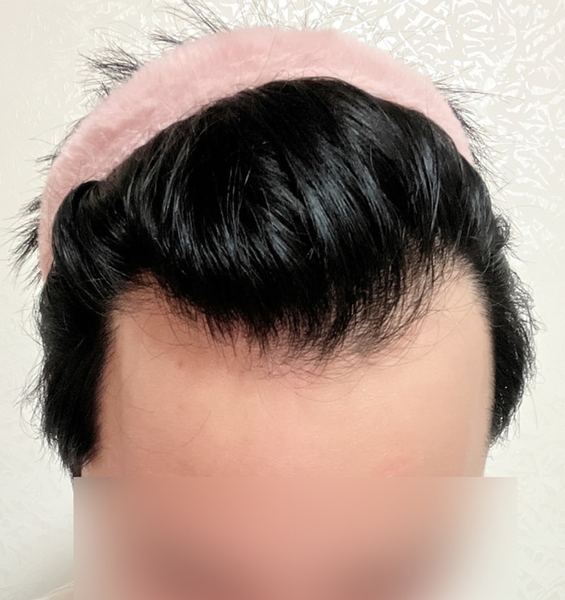 비포 1.jpg