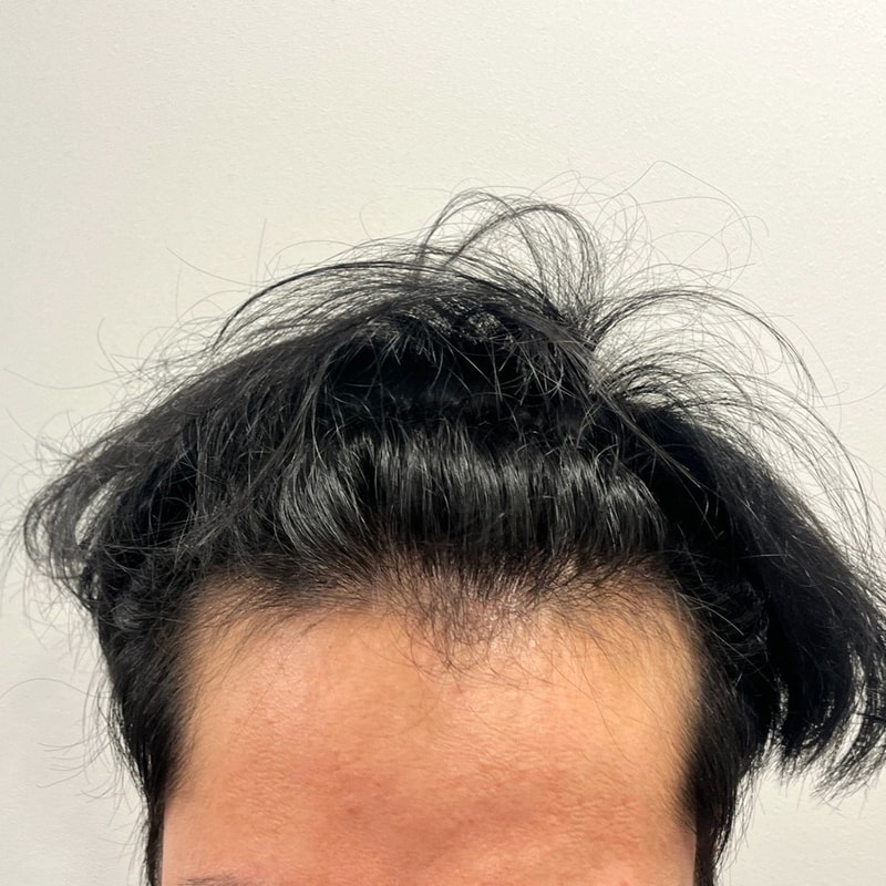 비포 2.jpg