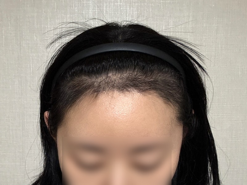 포토후기 이미지