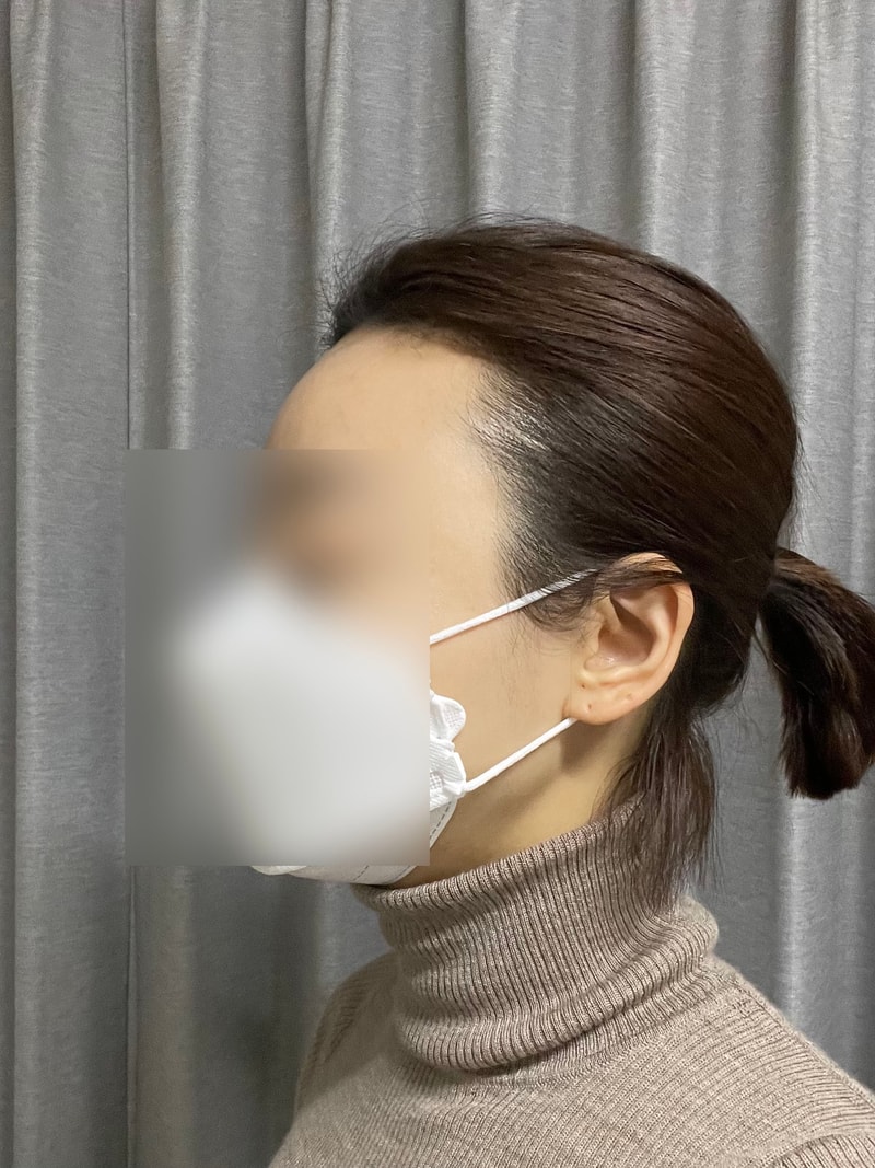 비포 2.jpg