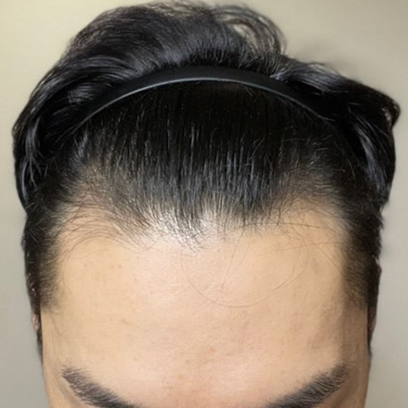 비포 2.jpg