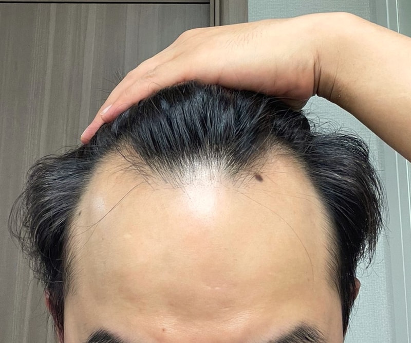 비포 1.jpg