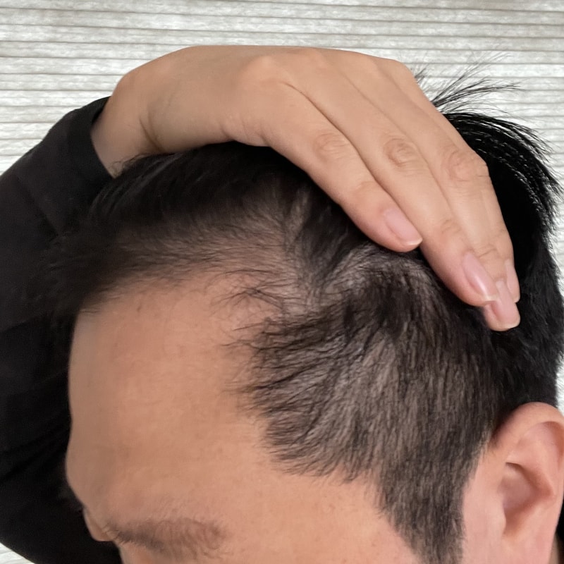 비포 1.jpg