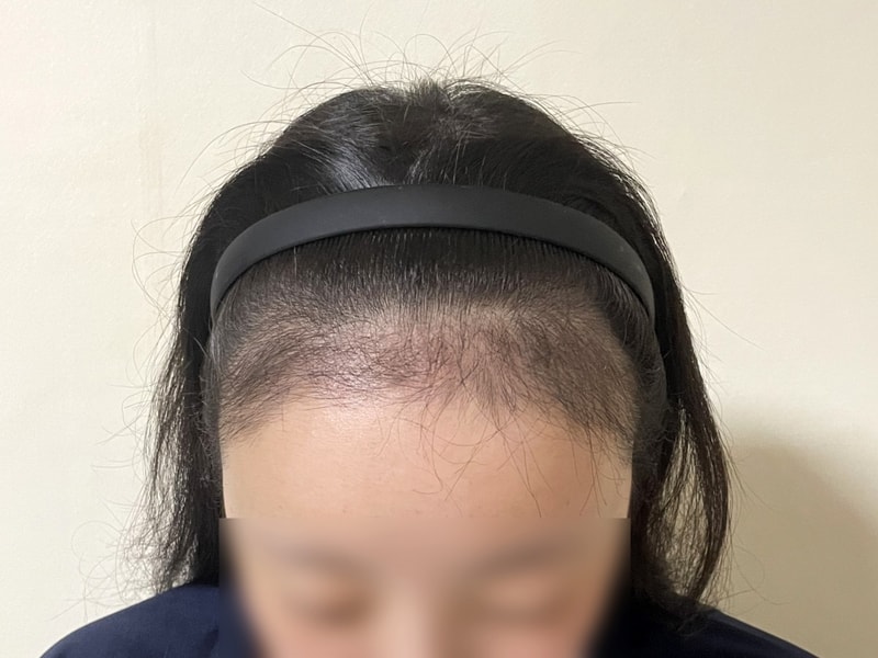 포토후기 이미지