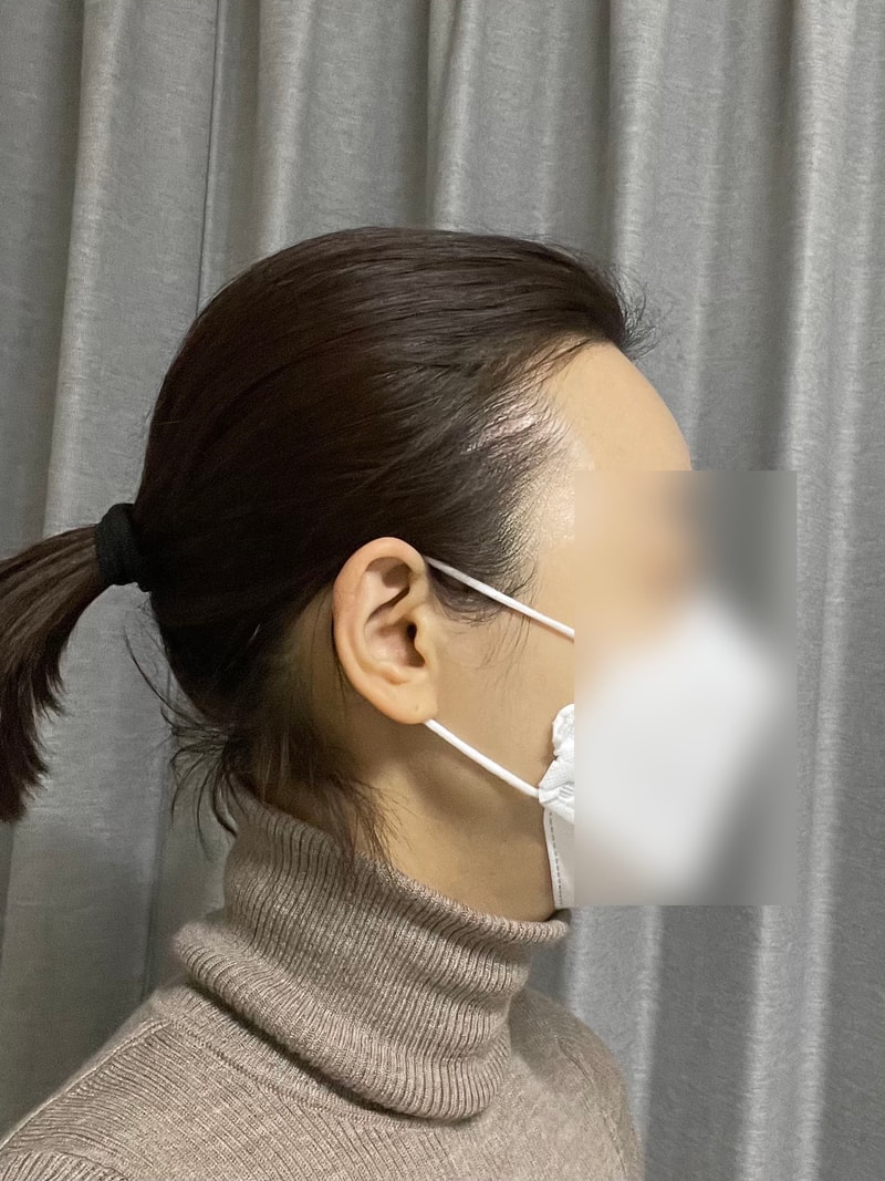 비포 1.jpg
