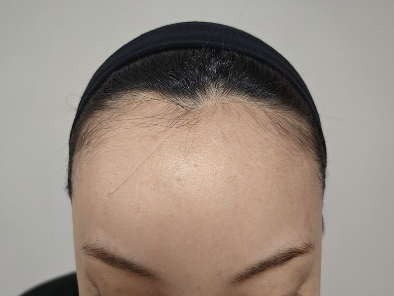 비포 1.jpg