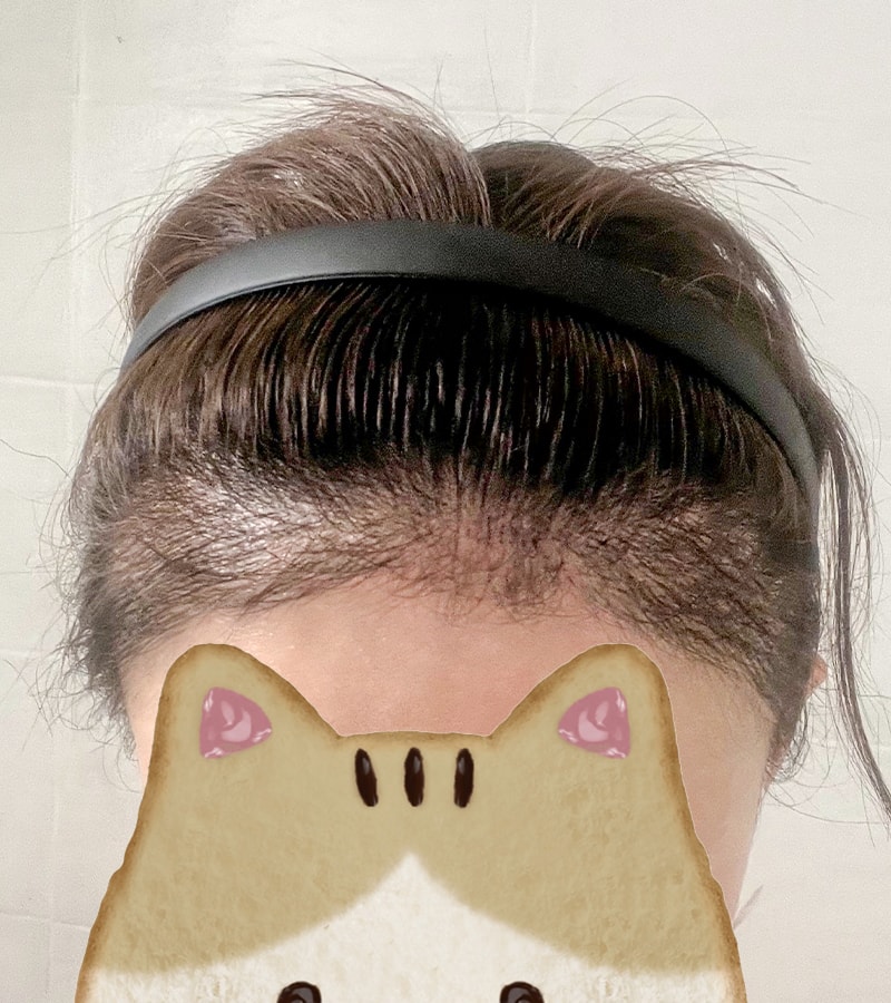 2500모 이식~~암흑기 끝난지 한달인데 엄청 자랐어용!