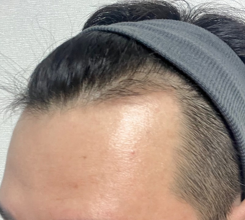 비포 3.jpg