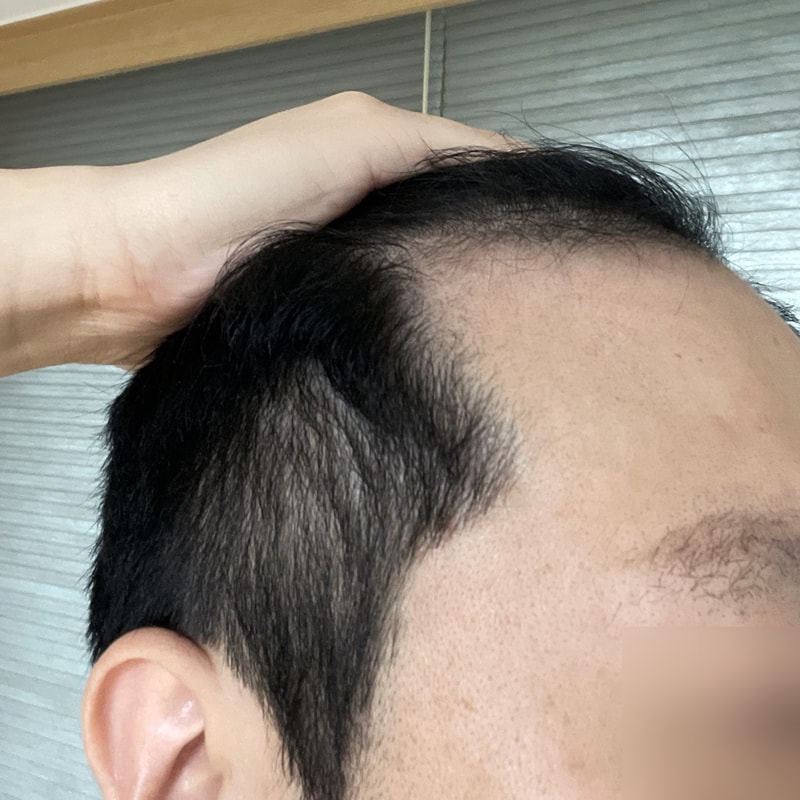 비포 2.jpg