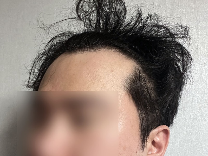 비포 3.jpg