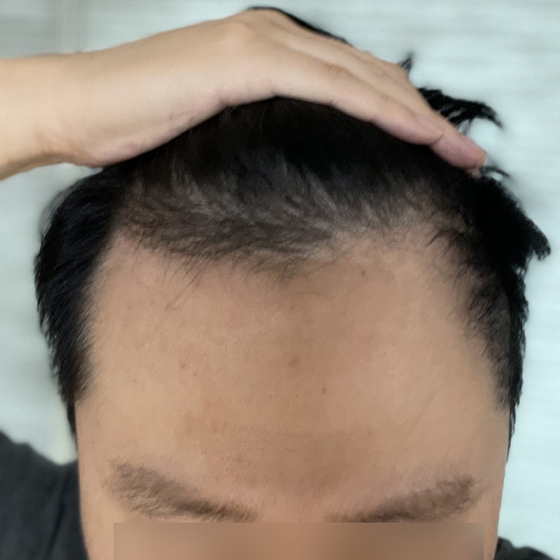 비포 3.jpg