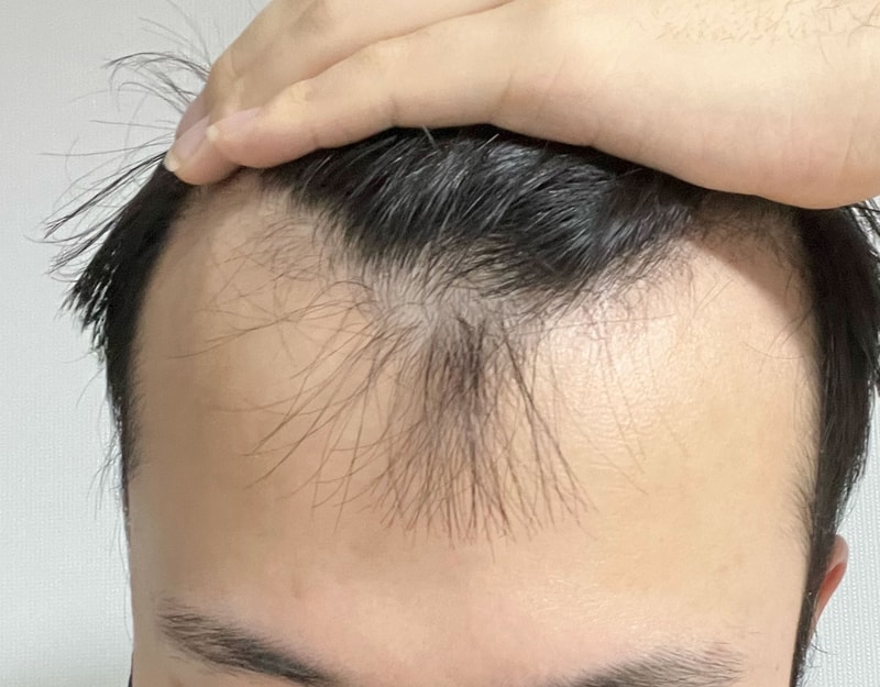 비포 1.jpg