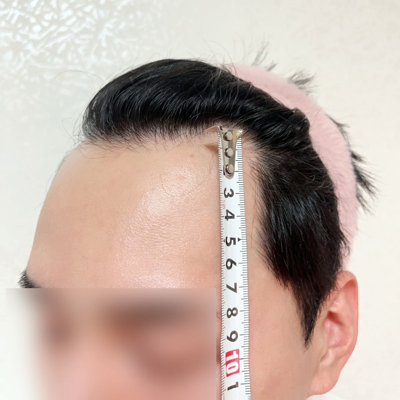 비포 2.jpg