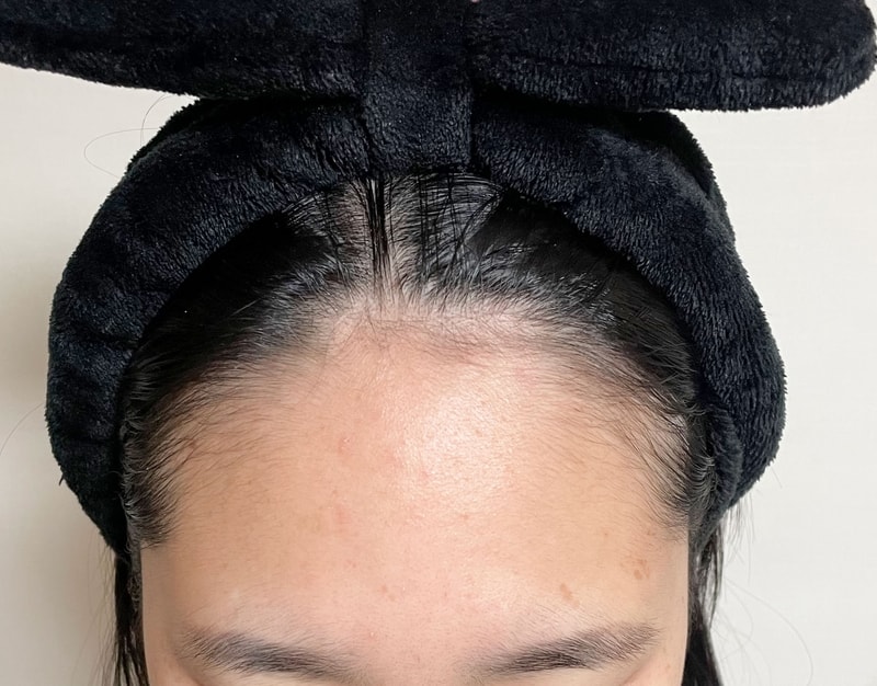 비포 1.jpg