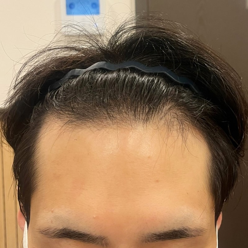비포 3.jpg