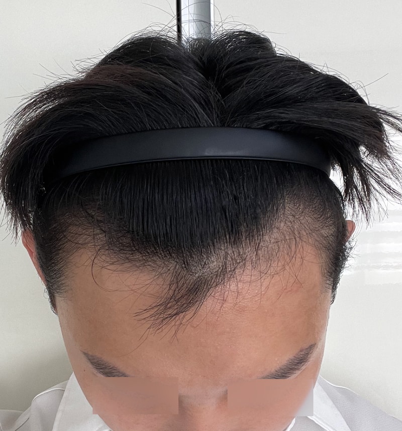 이마반5.jpg