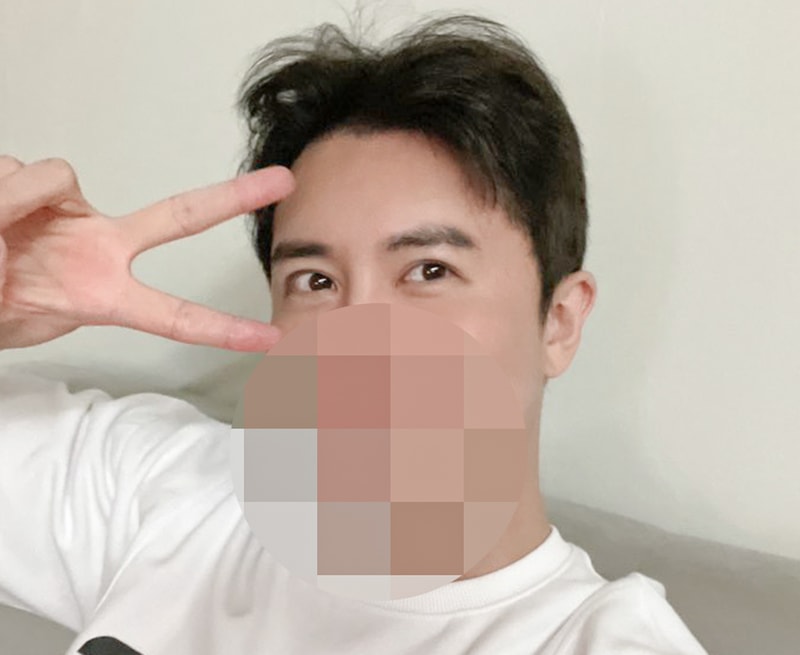 M자 개선된게 실감납니다~(2500모, 11개월)