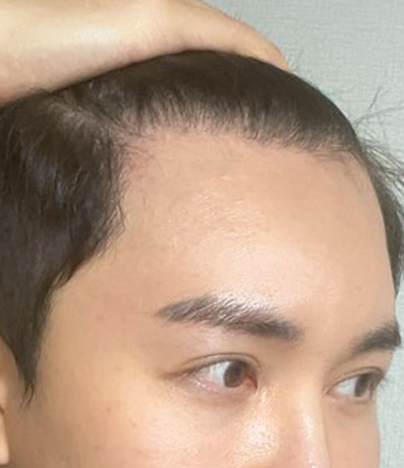 후2.jpg